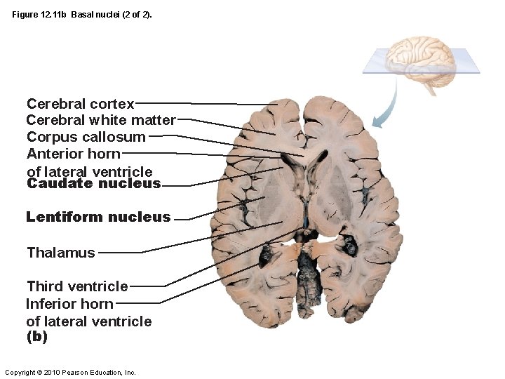 Figure 12. 11 b Basal nuclei (2 of 2). Cerebral cortex Cerebral white matter