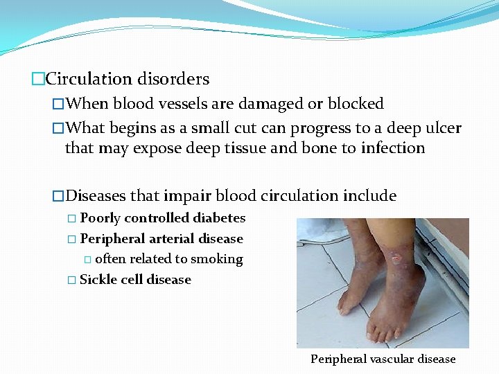 �Circulation disorders �When blood vessels are damaged or blocked �What begins as a small