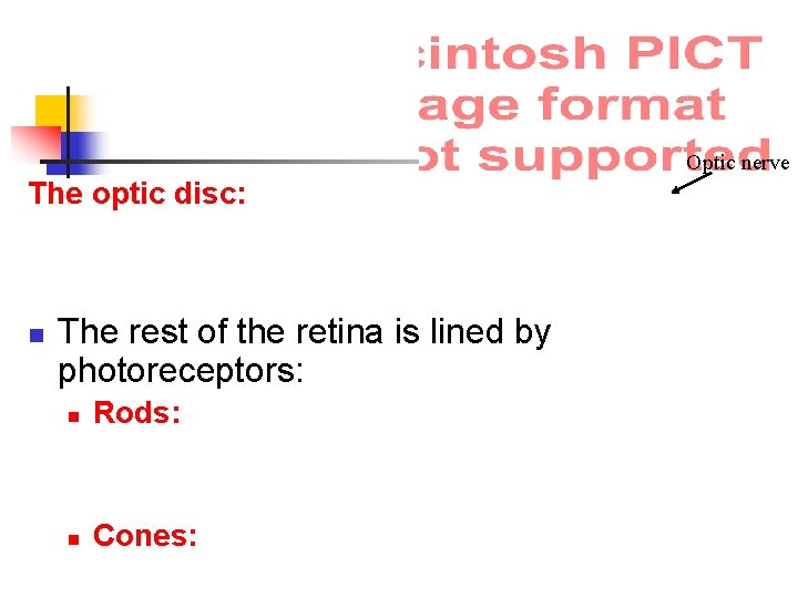 Optic nerve The optic disc: n The rest of the retina is lined by
