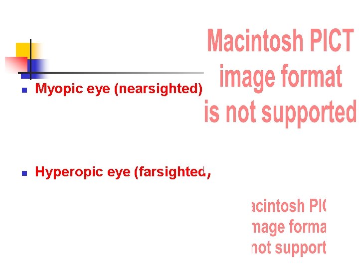 n Myopic eye (nearsighted) n Hyperopic eye (farsighted) 