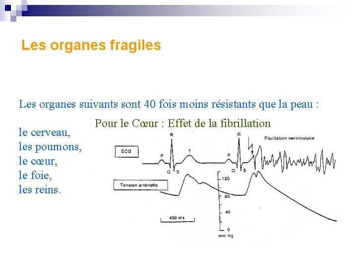 Les organes fragiles Les organes suivants sont 40 fois moins résistants que la peau