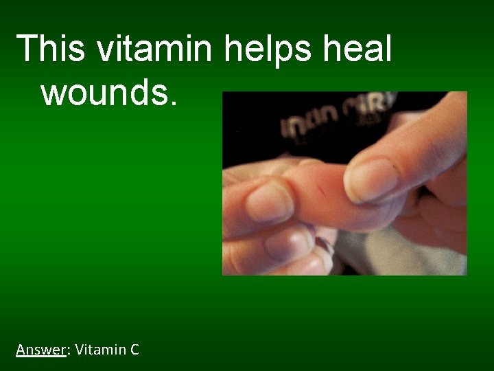 This vitamin helps heal wounds. Answer: Vitamin C 