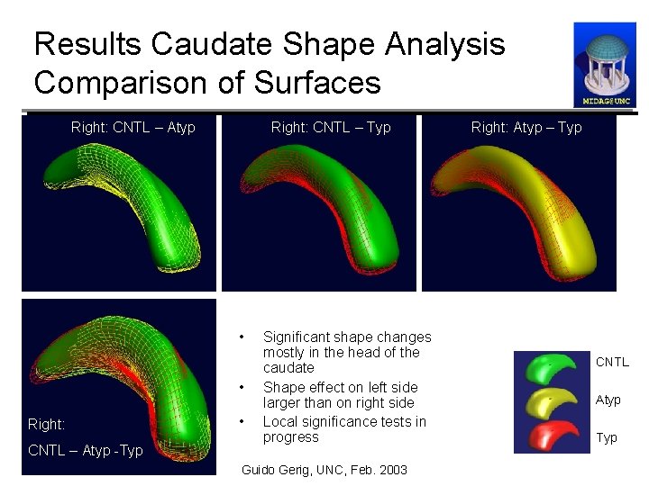 Results Caudate Shape Analysis Comparison of Surfaces Right: CNTL – Typ Right: CNTL –