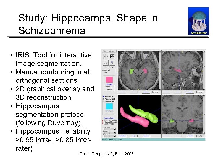 Study: Hippocampal Shape in Schizophrenia • IRIS: Tool for interactive image segmentation. • Manual