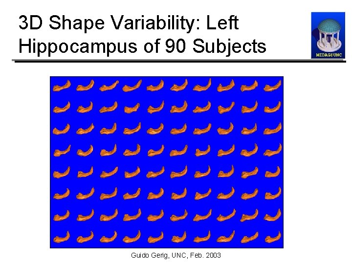 3 D Shape Variability: Left Hippocampus of 90 Subjects Guido Gerig, UNC, Feb. 2003