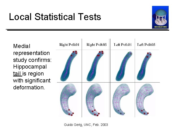 Local Statistical Tests Medial representation study confirms: Hippocampal tail is region with significant deformation.