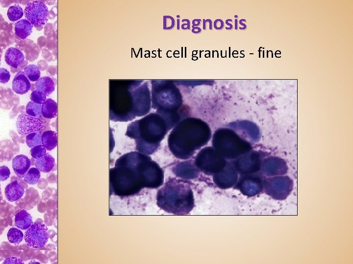 Diagnosis Mast cell granules - fine 