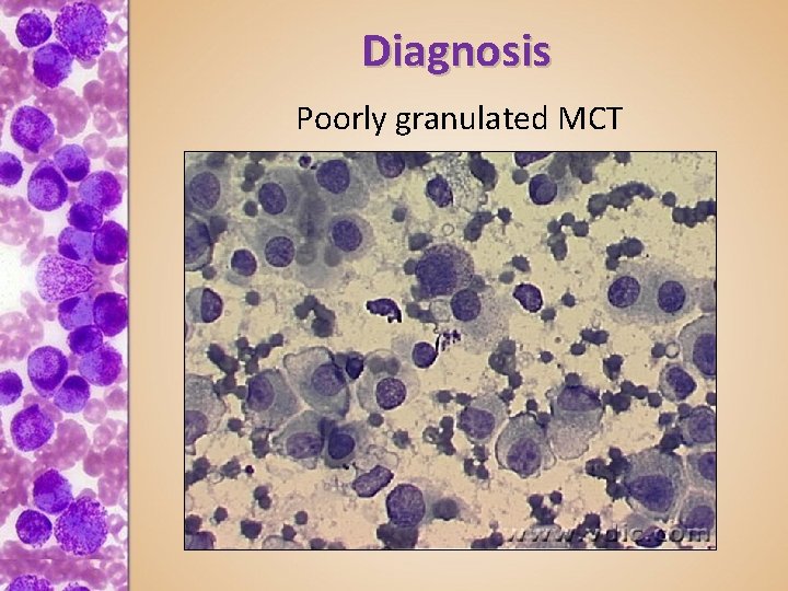 Diagnosis Poorly granulated MCT 