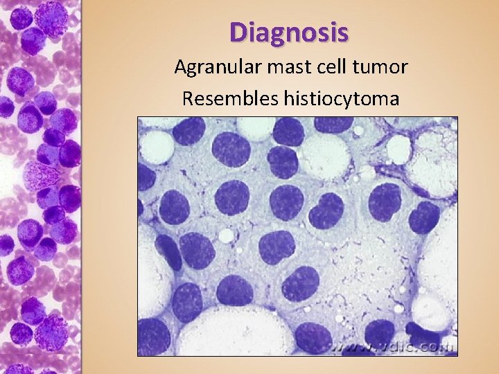 Diagnosis Agranular mast cell tumor Resembles histiocytoma 