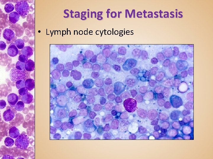 Staging for Metastasis • Lymph node cytologies 