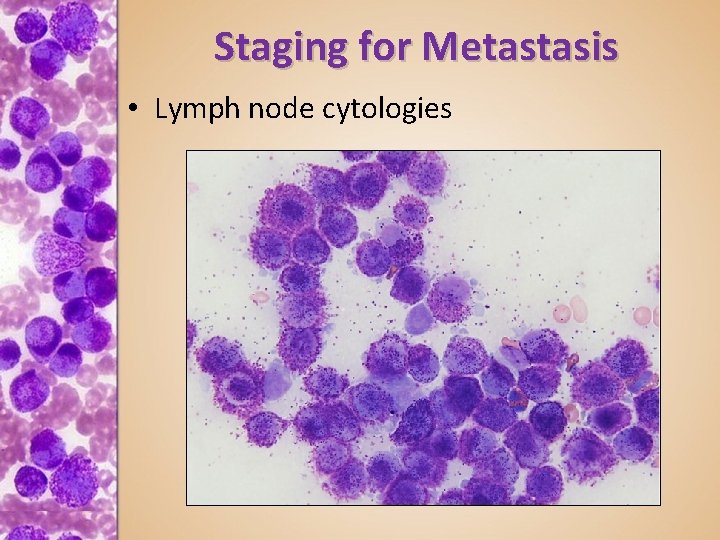 Staging for Metastasis • Lymph node cytologies 