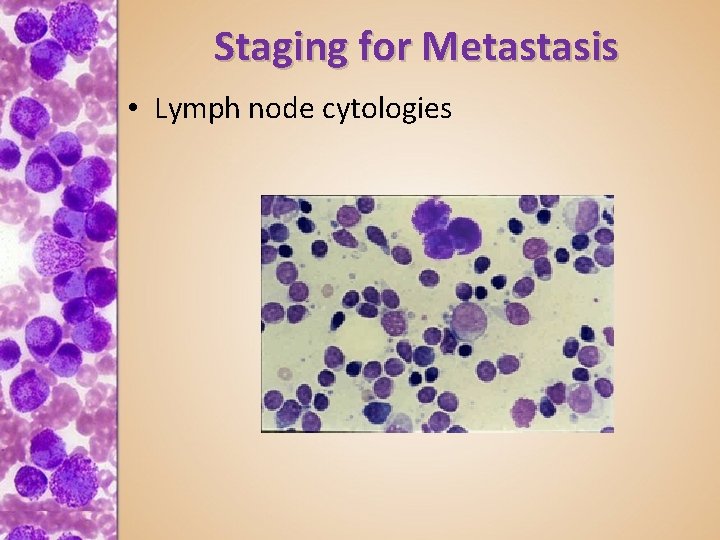 Staging for Metastasis • Lymph node cytologies 