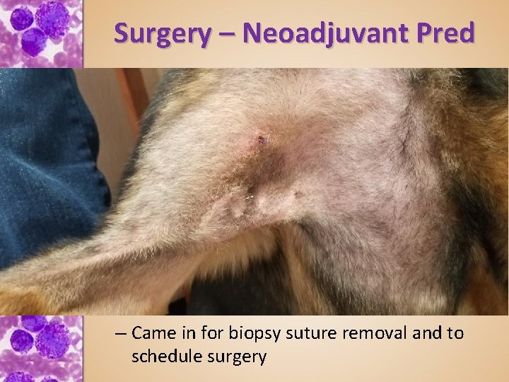 Surgery – Neoadjuvant Prednisone for pre-surgical cytoreduction • VCS 2018 – Klahn et al