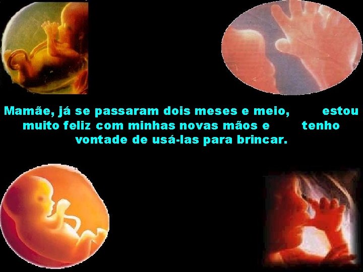 Mamãe, já se passaram dois meses e meio, muito feliz com minhas novas mãos