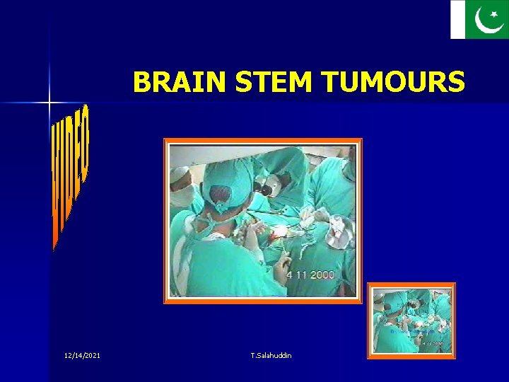 BRAIN STEM TUMOURS 12/14/2021 T. Salahuddin 