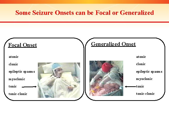 Some Seizure Onsets can be Focal or Generalized Focal Onset Generalized Onset atonic clonic