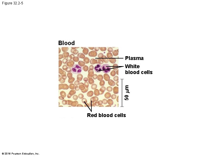 Figure 32. 2 -5 Blood Plasma 50 mm White blood cells Red blood cells
