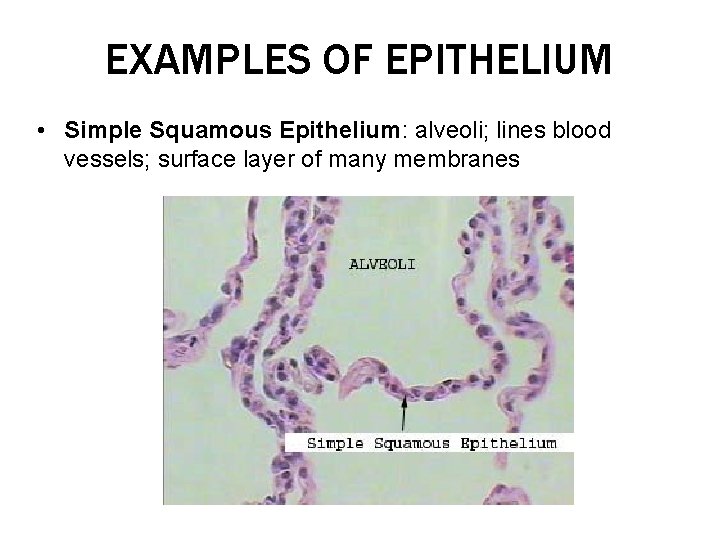EXAMPLES OF EPITHELIUM • Simple Squamous Epithelium: alveoli; lines blood vessels; surface layer of