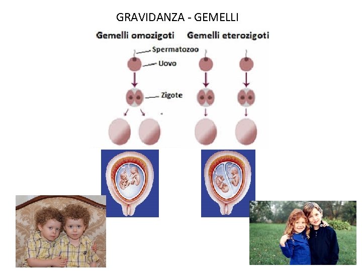 GRAVIDANZA - GEMELLI 
