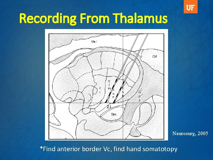 Recording From Thalamus Neurosurg, 2005 *Find anterior border Vc, find hand somatotopy 