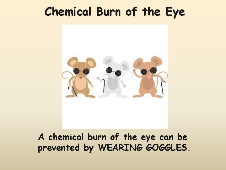 Chemical Burn of the Eye A chemical burn of the eye can be prevented