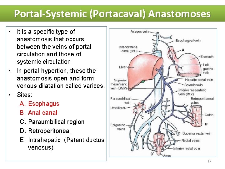 Portal-Systemic (Portacaval) Anastomoses • It is a specific type of anastomosis that occurs between