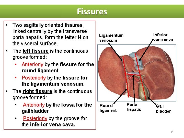 Fissures • Two sagittally oriented fissures, linked centrally by the transverse porta hepatis, form
