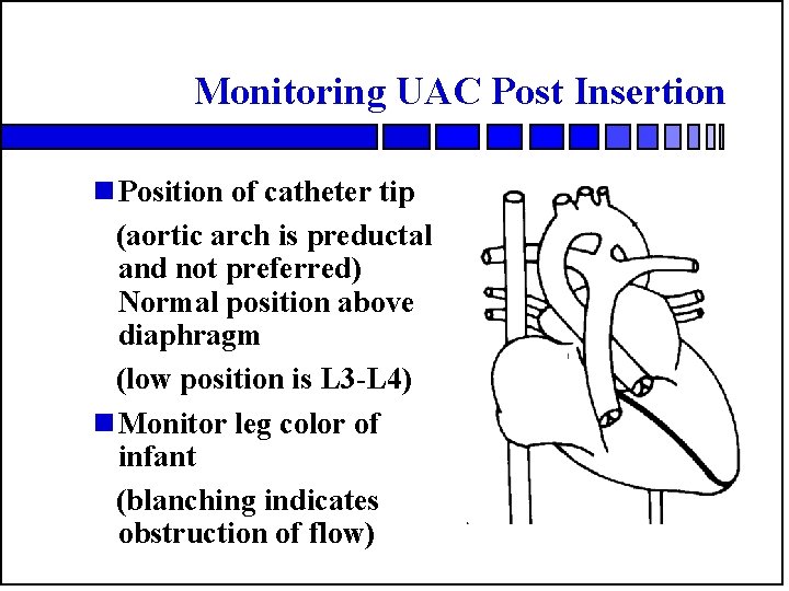 Monitoring UAC Post Insertion n Position of catheter tip (aortic arch is preductal and