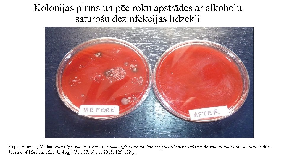 Kolonijas pirms un pēc roku apstrādes ar alkoholu saturošu dezinfekcijas līdzekli Kapil, Bhavsar, Madan.