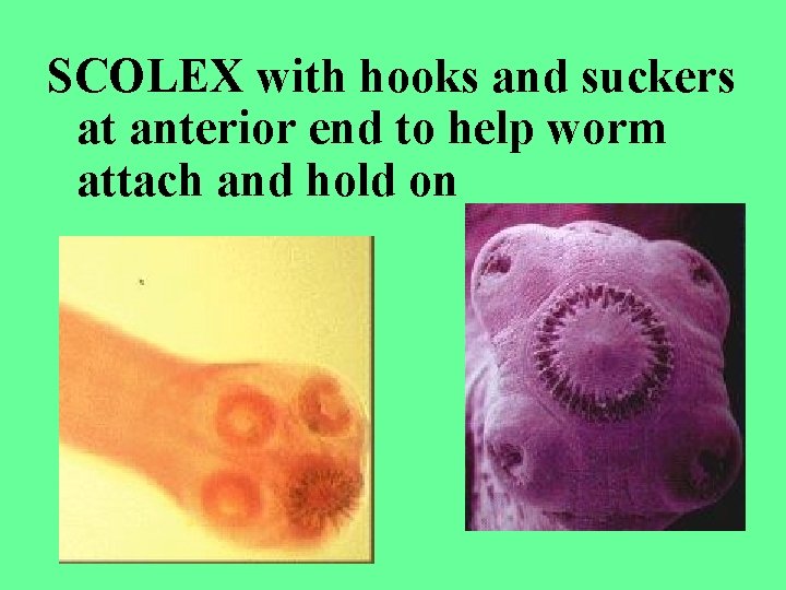 SCOLEX with hooks and suckers at anterior end to help worm attach and hold