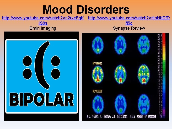 Mood Disorders http: //www. youtube. com/watch? v=2 rxe. Fg. K IS 9 s Brain