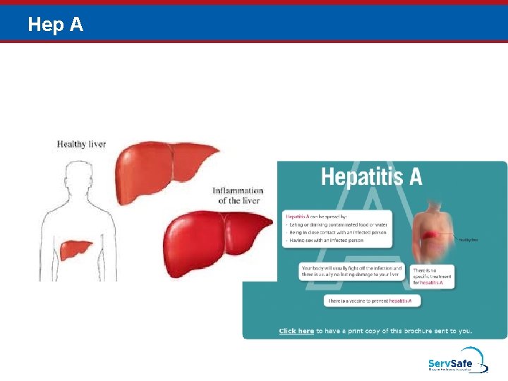 Hep A 