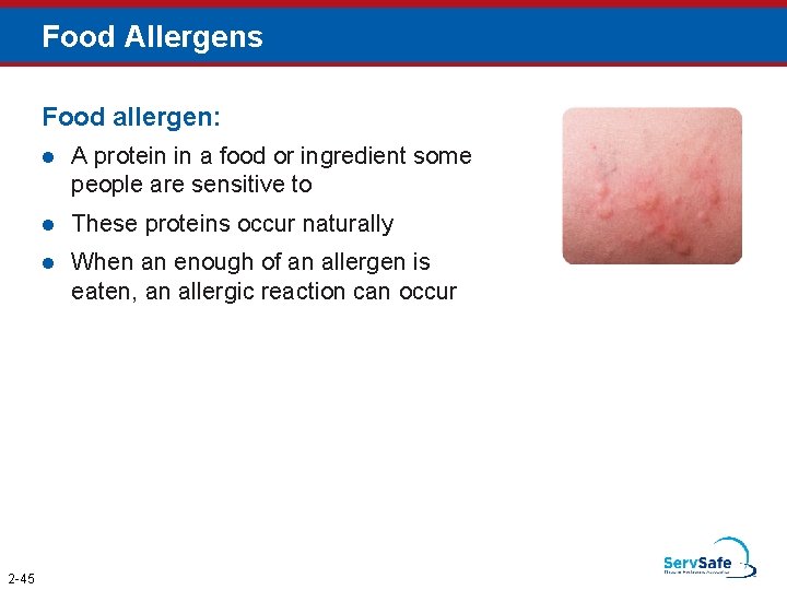 Food Allergens Food allergen: 2 -45 l A protein in a food or ingredient