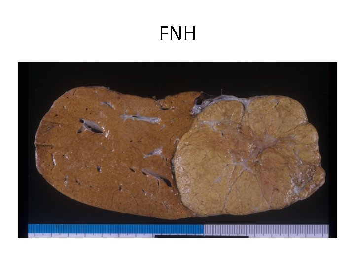 FNH 