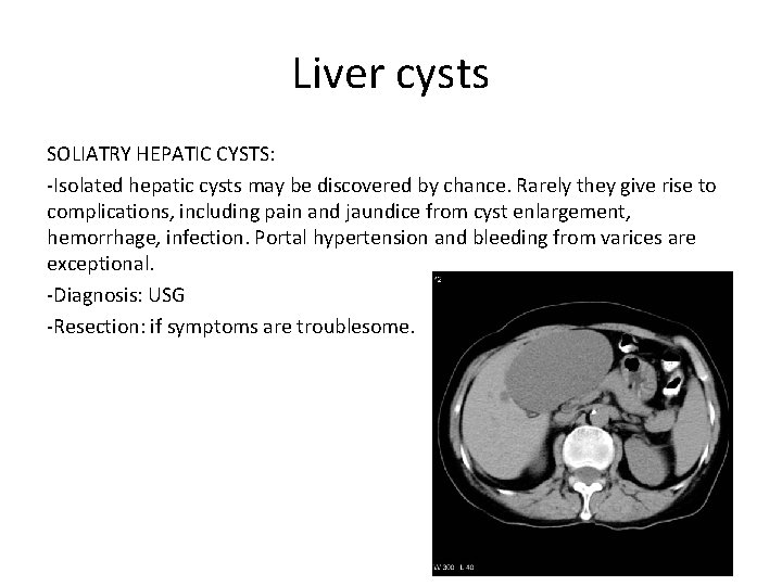 Liver cysts SOLIATRY HEPATIC CYSTS: -Isolated hepatic cysts may be discovered by chance. Rarely