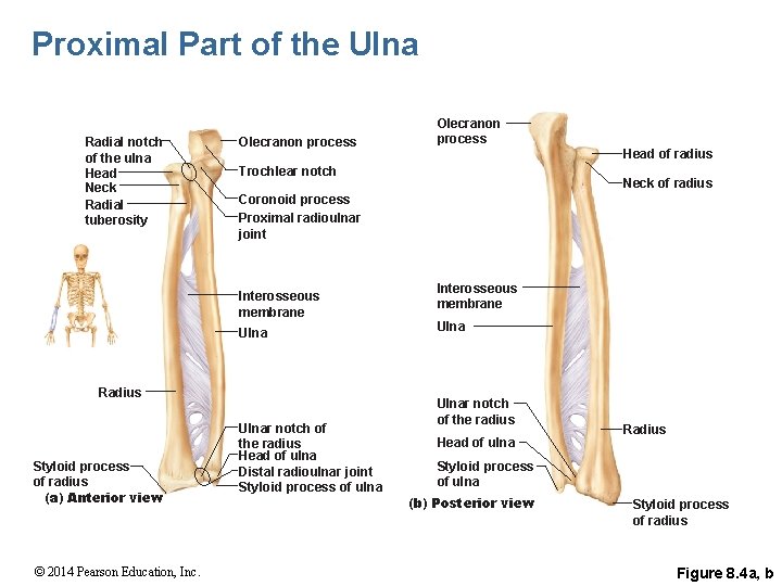 Proximal Part of the Ulna Radial notch of the ulna Head Neck Radial tuberosity