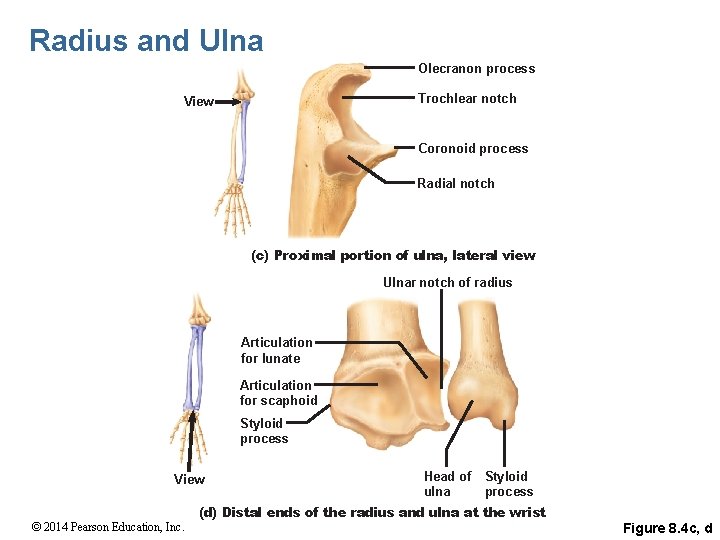 Radius and Ulna Olecranon process Trochlear notch View Coronoid process Radial notch (c) Proximal