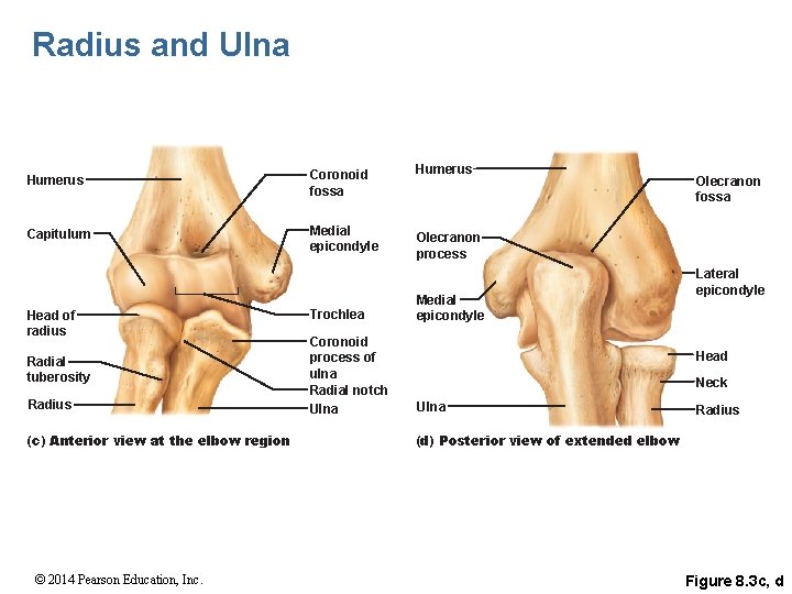 Radius and Ulna Humerus Coronoid fossa Capitulum Medial epicondyle Head of radius Radial tuberosity