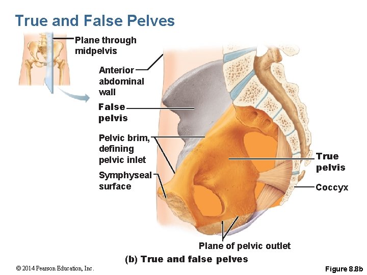 True and False Pelves Plane through midpelvis Anterior abdominal wall False pelvis Pelvic brim,