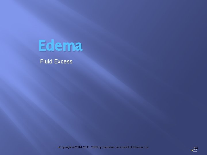 Edema Fluid Excess • Copyright © 2014, 2011, 2006 by Saunders, an imprint of