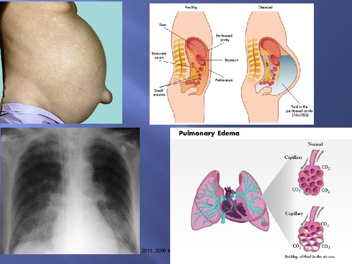  • Copyright © 2014, 2011, 2006 by Saunders, an imprint of Elsevier, Inc.
