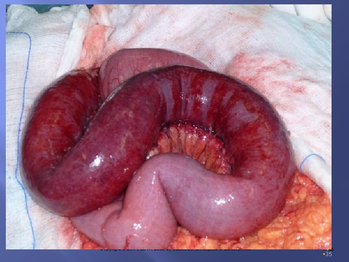  • Copyright © 2014, 2011, 2006 by Saunders, an imprint of Elsevier, Inc.