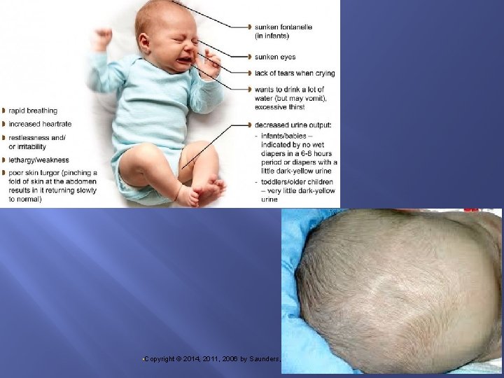  • Copyright © 2014, 2011, 2006 by Saunders, an imprint of Elsevier, Inc.