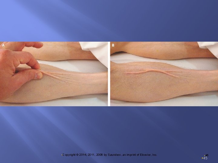  • Copyright © 2014, 2011, 2006 by Saunders, an imprint of Elsevier, Inc.