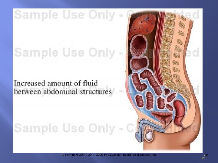  • Copyright © 2014, 2011, 2006 by Saunders, an imprint of Elsevier, Inc.