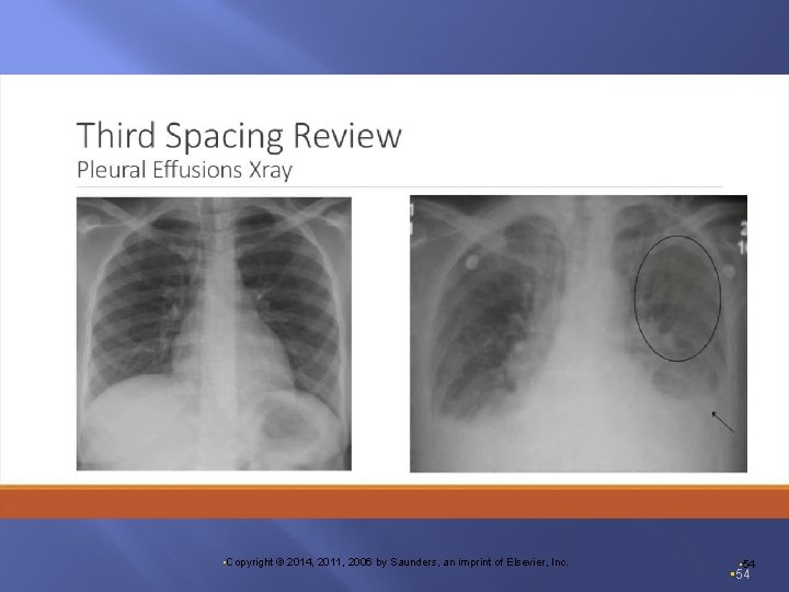  • Copyright © 2014, 2011, 2006 by Saunders, an imprint of Elsevier, Inc.