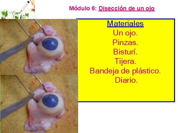 Módulo 6: Disección de un ojo Materiales Un ojo. Pinzas. Bisturí. Tijera. Bandeja de