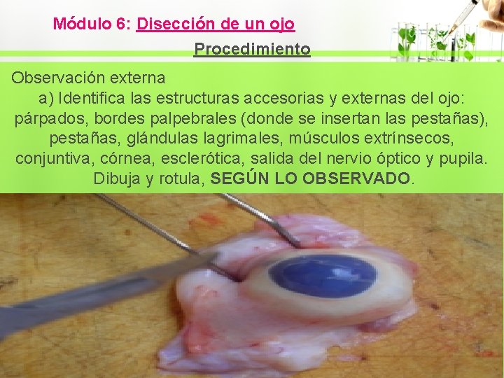 Módulo 6: Disección de un ojo Procedimiento Observación externa a) Identifica las estructuras accesorias