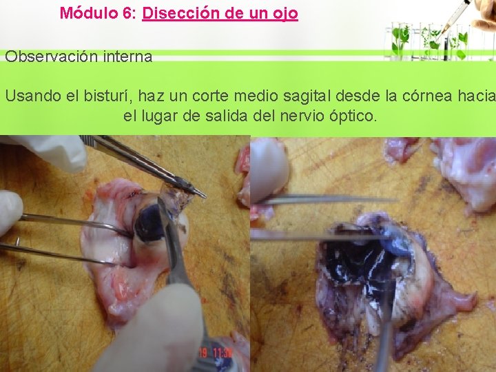 Módulo 6: Disección de un ojo Observación interna Usando el bisturí, haz un corte