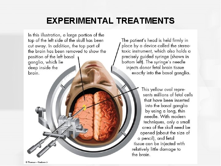 EXPERIMENTAL TREATMENTS 